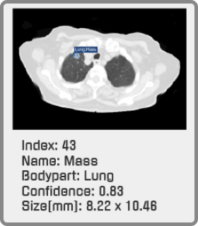 lung hover